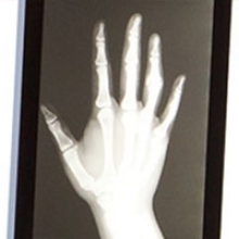 Hand x-ray